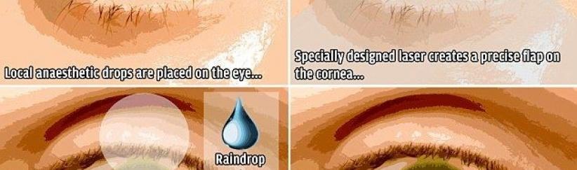 جهاز جديد في العين يغنيك عن نظارات القراءة