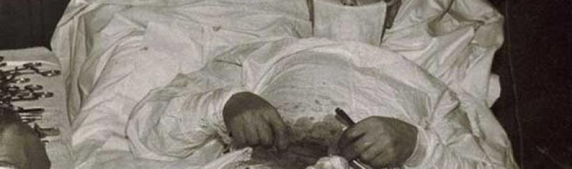 طبيب يجري لنفسه عملية 