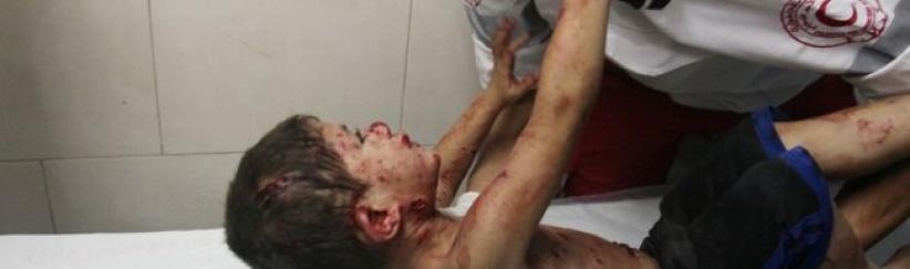 اطباء بلا حدود: اطفال غزة المصابين في الحرب ما زالوا يعالجون