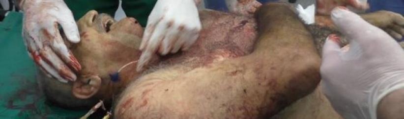 استشهاد مواطن واصابة نجليه في بيت امر بالخليل