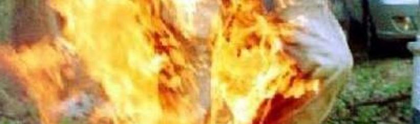 وفاة شاب أضرم النار في نفسه بغزة