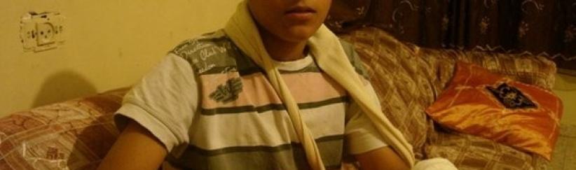 الجليل- بتر أصابع طفل كان يلهو بالمفرقعات