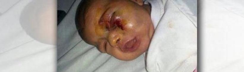 اعتدى على ابنته الرضيعة بشكل وحشي... بسبب بكائها