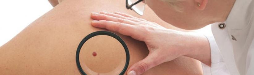 الأطباء يحددون اعراض الأمراض السرطانية التي تستوجب مراجعة الطبيب