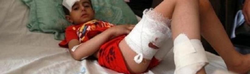 اكثر من 500 طفل قتلوا في اليمن منذ اندلاع النزاع