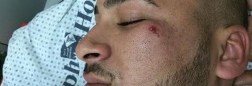 مستوطنون يعتدون على شاب مقدسي بآلة حادة