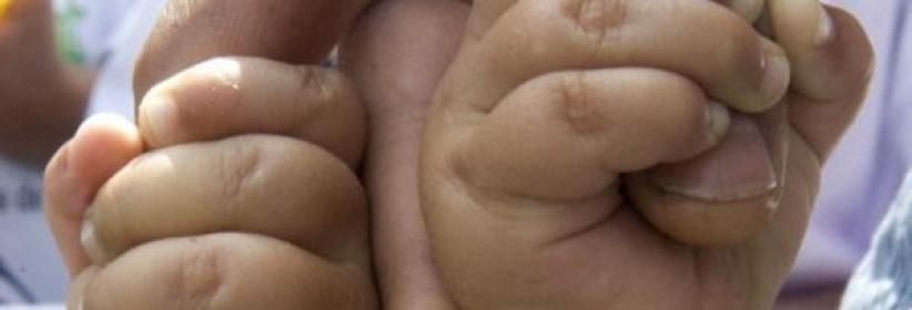 قضية غريبة.. توأمان من أبوين مختلفين