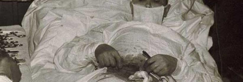 طبيب يجري لنفسه عملية 