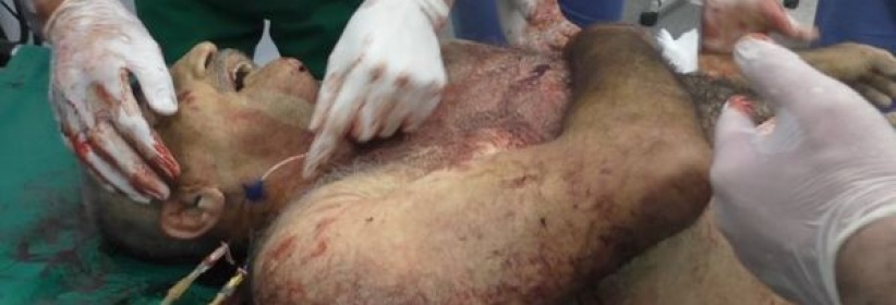 استشهاد مواطن واصابة نجليه في بيت امر بالخليل