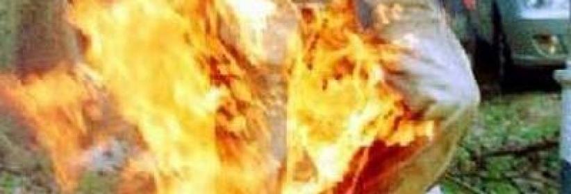 وفاة شاب أضرم النار في نفسه بغزة
