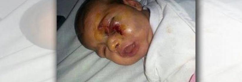 اعتدى على ابنته الرضيعة بشكل وحشي... بسبب بكائها