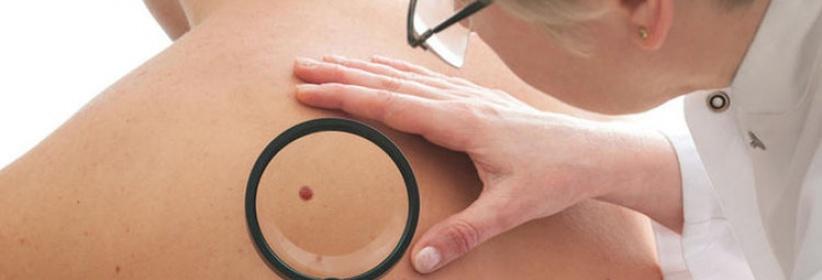 الأطباء يحددون اعراض الأمراض السرطانية التي تستوجب مراجعة الطبيب