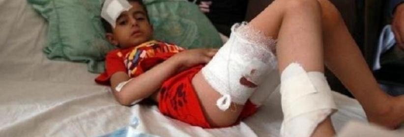 اكثر من 500 طفل قتلوا في اليمن منذ اندلاع النزاع