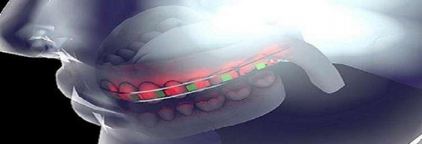 جامعة سعودية تطور تقنية جديدة لتقويم الأسنان