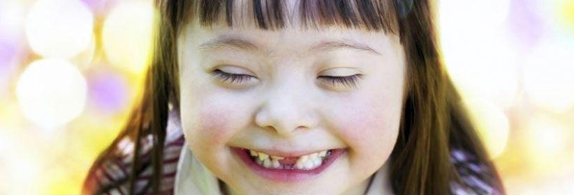 دراسة تبعث الأمل لإيجاد علاج شخصي لمرضى متلازمة داون