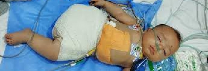 15 ألف مبتور أطرافهم واحتياجات طبية عاجلة في غزة