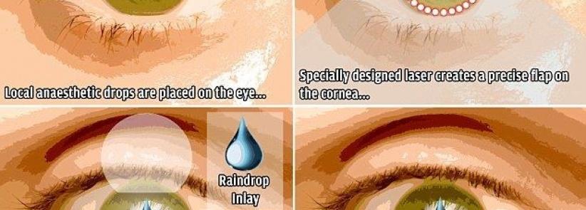 جهاز جديد في العين يغنيك عن نظارات القراءة