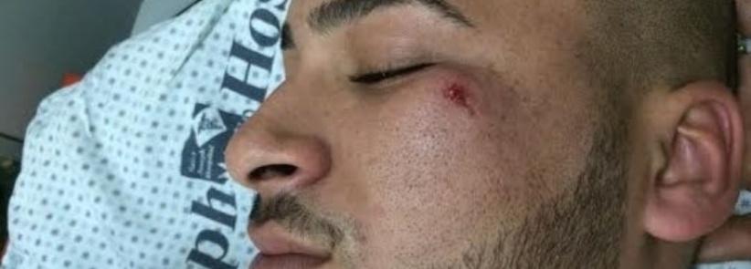 مستوطنون يعتدون على شاب مقدسي بآلة حادة