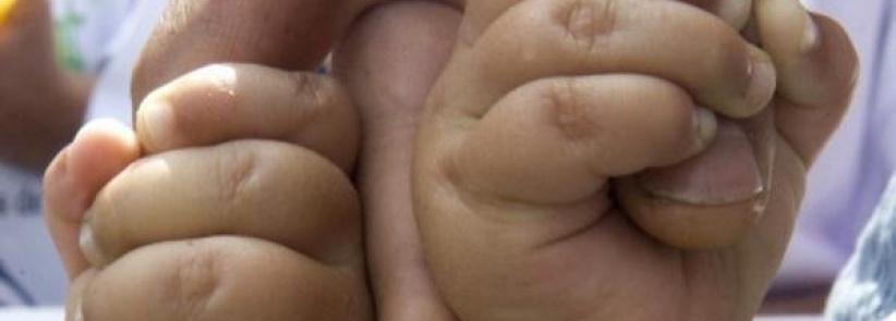 قضية غريبة.. توأمان من أبوين مختلفين