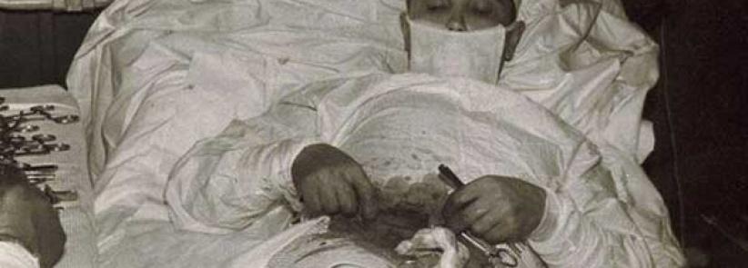 طبيب يجري لنفسه عملية 