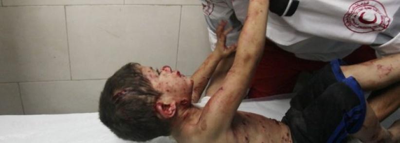 اطباء بلا حدود: اطفال غزة المصابين في الحرب ما زالوا يعالجون