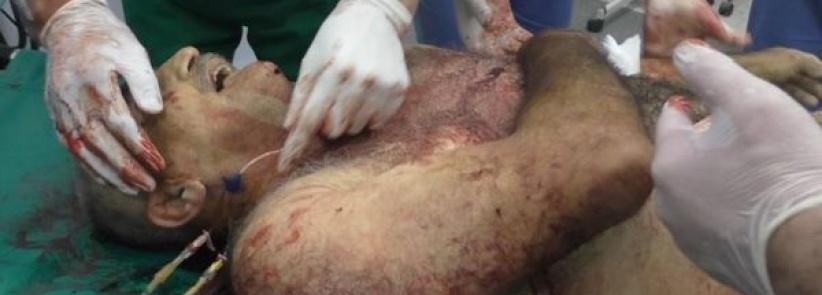 استشهاد مواطن واصابة نجليه في بيت امر بالخليل