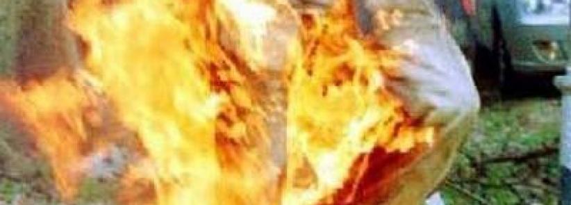 وفاة شاب أضرم النار في نفسه بغزة