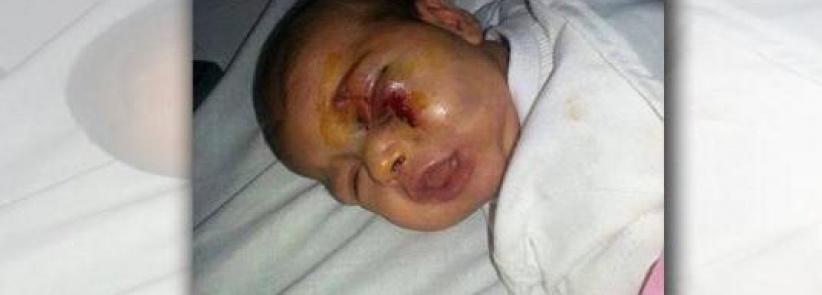 اعتدى على ابنته الرضيعة بشكل وحشي... بسبب بكائها