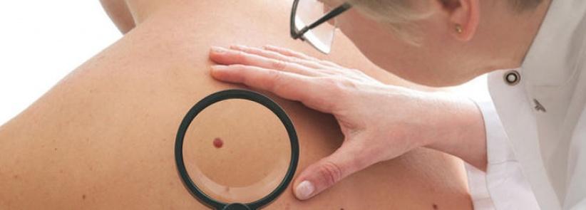 الأطباء يحددون اعراض الأمراض السرطانية التي تستوجب مراجعة الطبيب