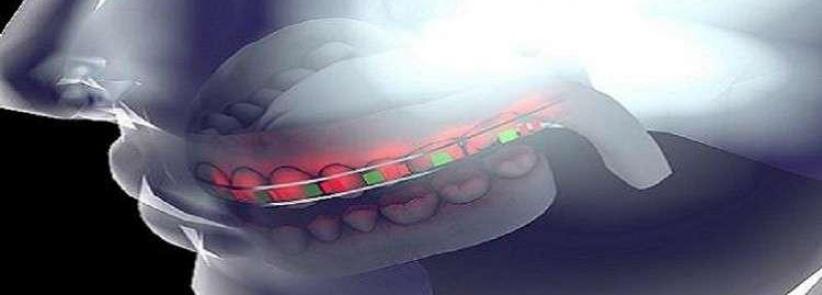 جامعة سعودية تطور تقنية جديدة لتقويم الأسنان
