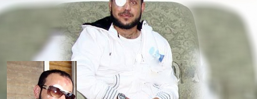 استشهاد شاب من طولكرم متاثرا بجراح اصيب بها على يد الاحتلال قبل 9 سنوات