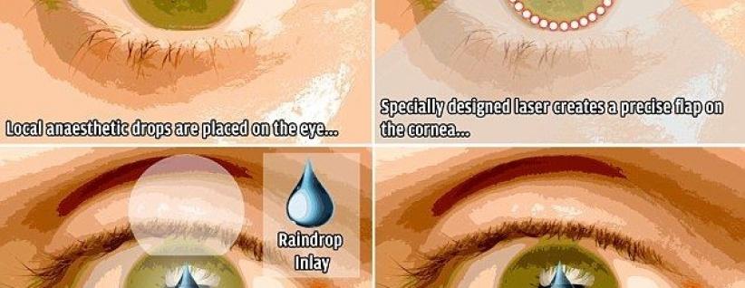 جهاز جديد في العين يغنيك عن نظارات القراءة