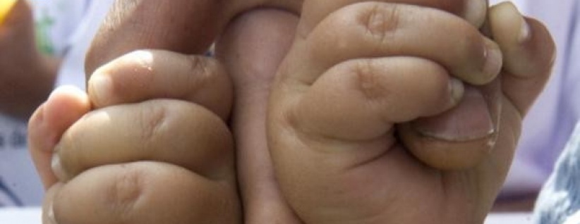 قضية غريبة.. توأمان من أبوين مختلفين