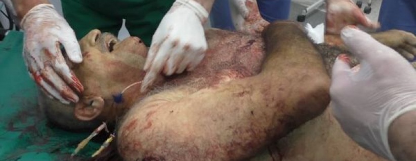 استشهاد مواطن واصابة نجليه في بيت امر بالخليل