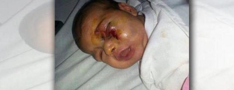 اعتدى على ابنته الرضيعة بشكل وحشي... بسبب بكائها