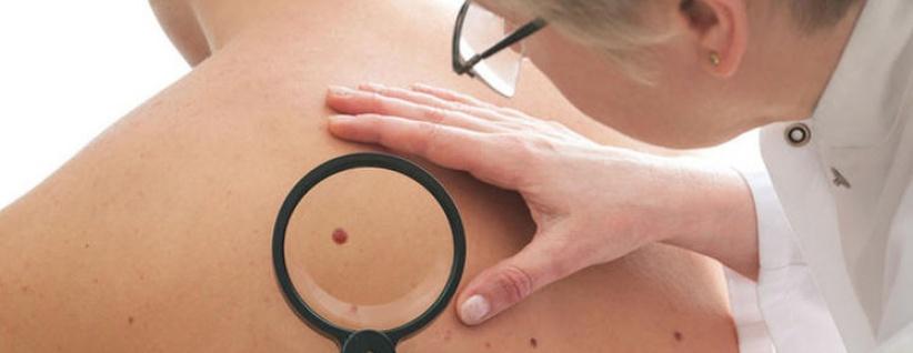 الأطباء يحددون اعراض الأمراض السرطانية التي تستوجب مراجعة الطبيب