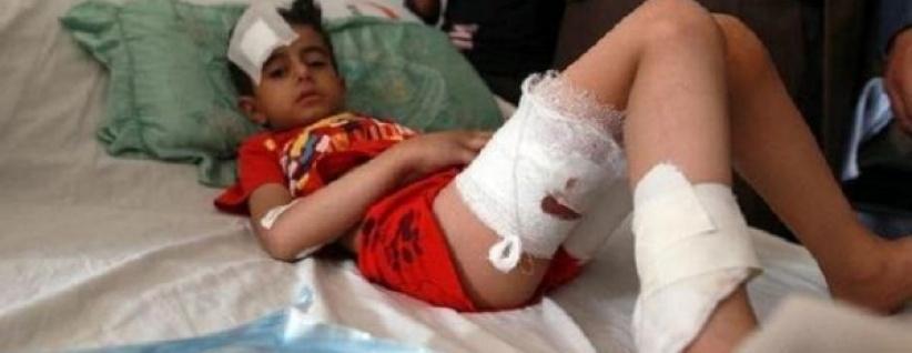 اكثر من 500 طفل قتلوا في اليمن منذ اندلاع النزاع