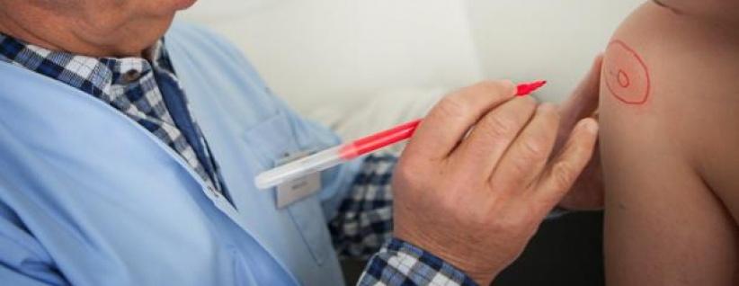 تطوير اختبار سريع يشخّص حالات الحساسية في 8 دقائق