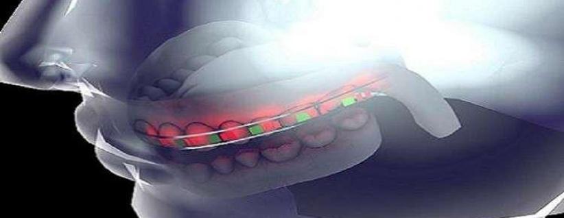 جامعة سعودية تطور تقنية جديدة لتقويم الأسنان