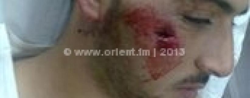 اصابة شاب برصاصة معدنية بوجهه في مواجهات بمخيم عايدة