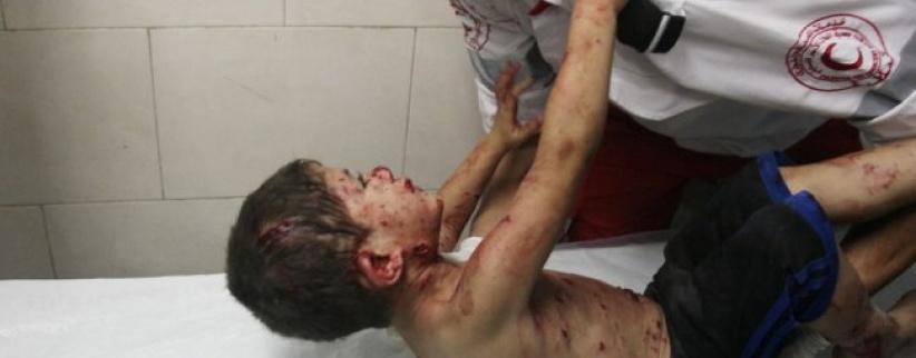 اطباء بلا حدود: اطفال غزة المصابين في الحرب ما زالوا يعالجون