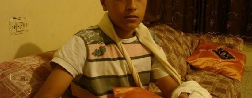 الجليل- بتر أصابع طفل كان يلهو بالمفرقعات