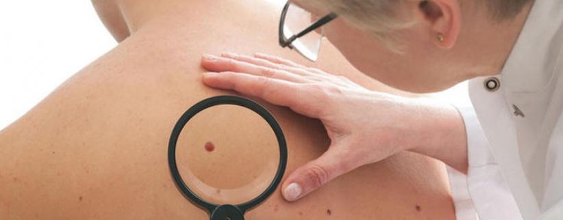 الأطباء يحددون اعراض الأمراض السرطانية التي تستوجب مراجعة الطبيب