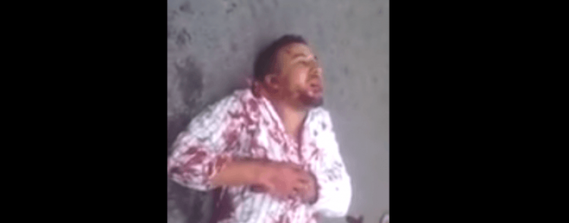 شاهد لحظة الإعتداء على رجل بالاسلحة البيضاء وتسديد عدة طعنات له