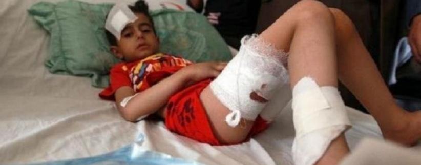 اكثر من 500 طفل قتلوا في اليمن منذ اندلاع النزاع