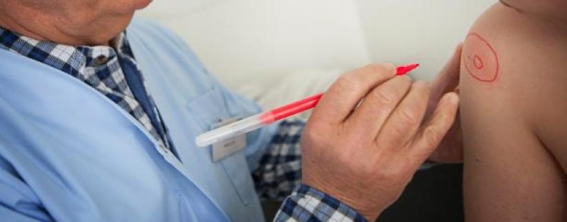 تطوير اختبار سريع يشخّص حالات الحساسية في 8 دقائق