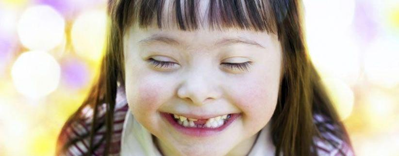 دراسة تبعث الأمل لإيجاد علاج شخصي لمرضى متلازمة داون