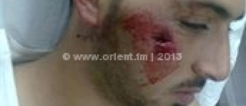 اصابة شاب برصاصة معدنية بوجهه في مواجهات بمخيم عايدة