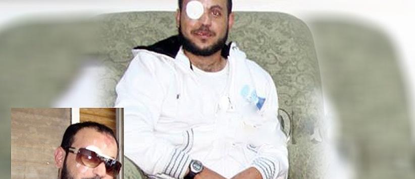 استشهاد شاب من طولكرم متاثرا بجراح اصيب بها على يد الاحتلال قبل 9 سنوات