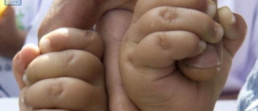 قضية غريبة.. توأمان من أبوين مختلفين